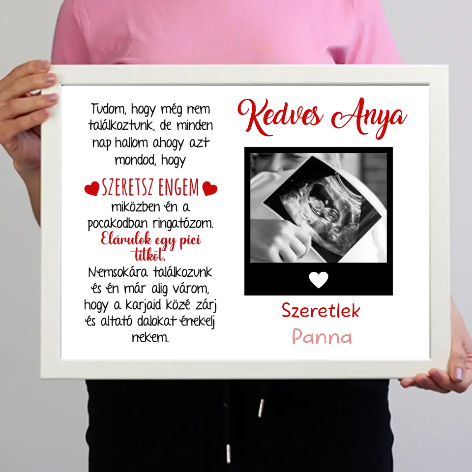 Egyedi ultrahang képes falikép Várandós Anyukáknak