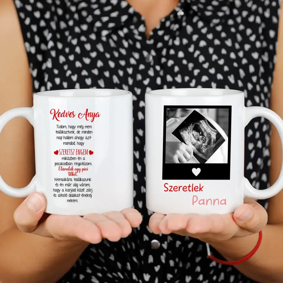 Egyedi ultrahang képes bögre Várandós Anyukáknak