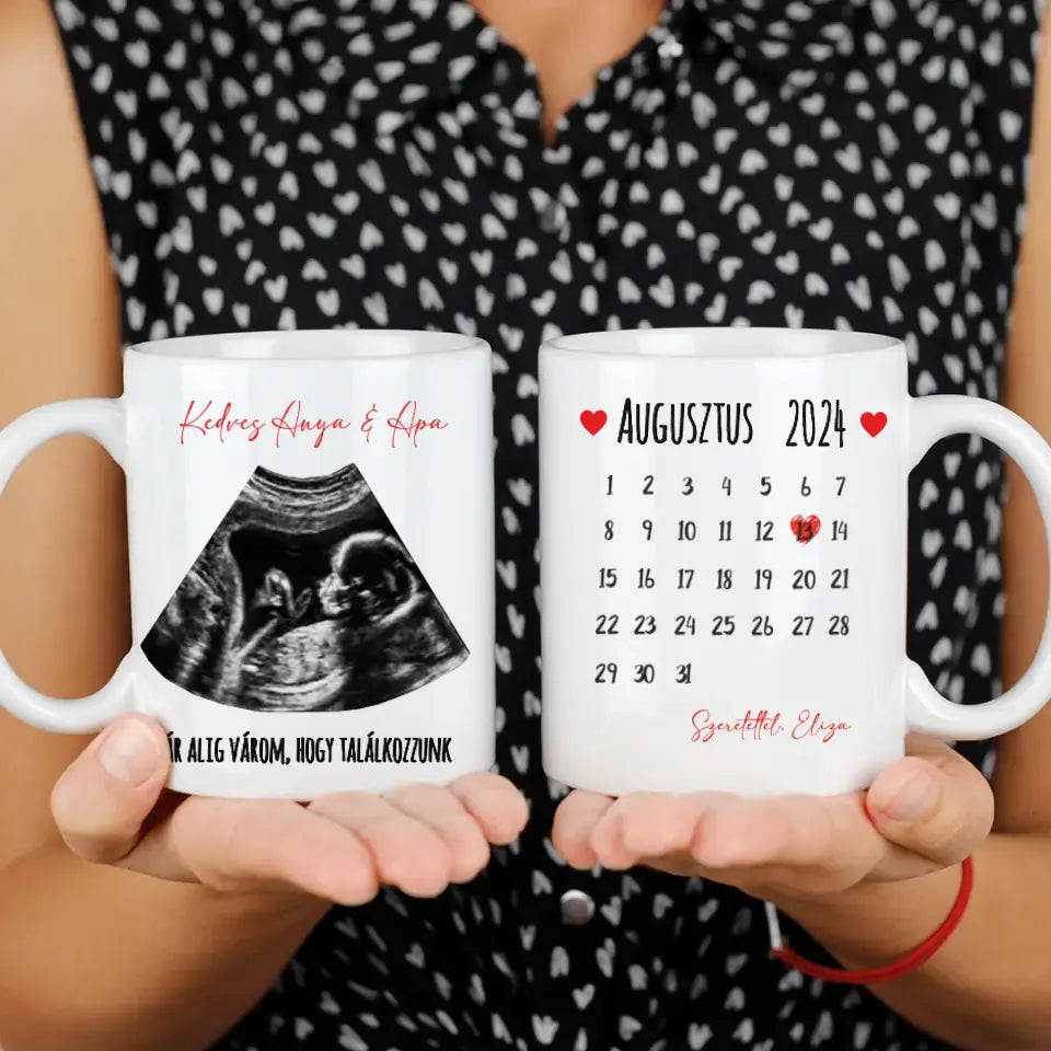 Egyedi ultrahang képes bögre naptárral, Várandós Anyukáknak