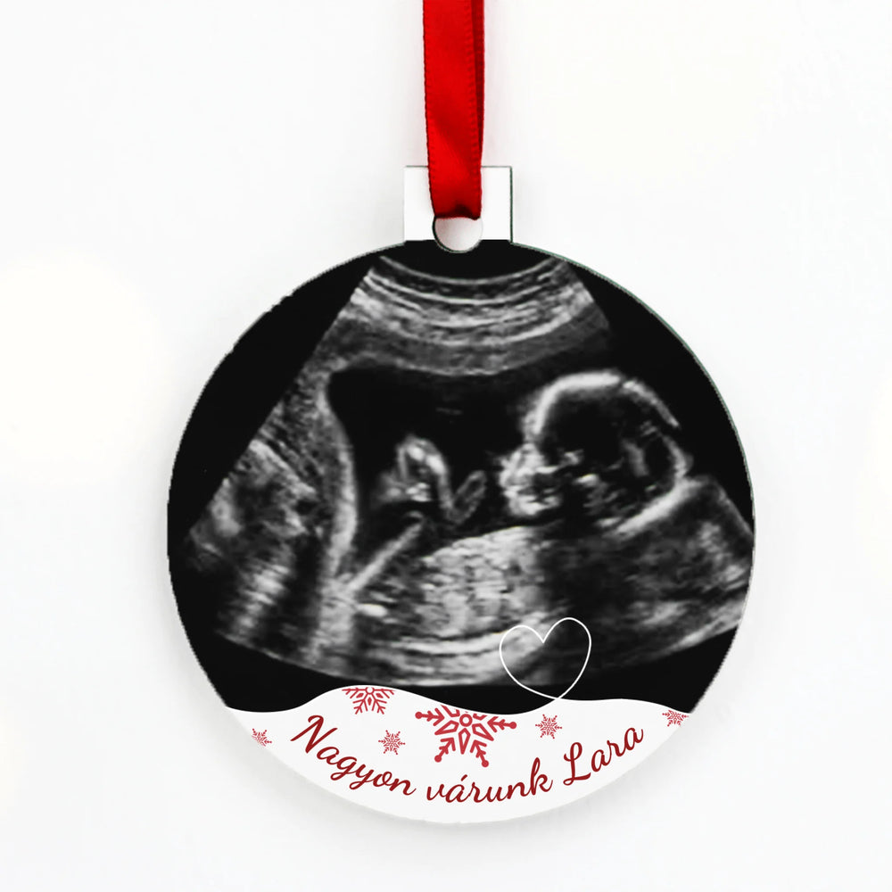 Ultrahang képes ajándék kör karácsonyfadísz szerkeszthető felirattal