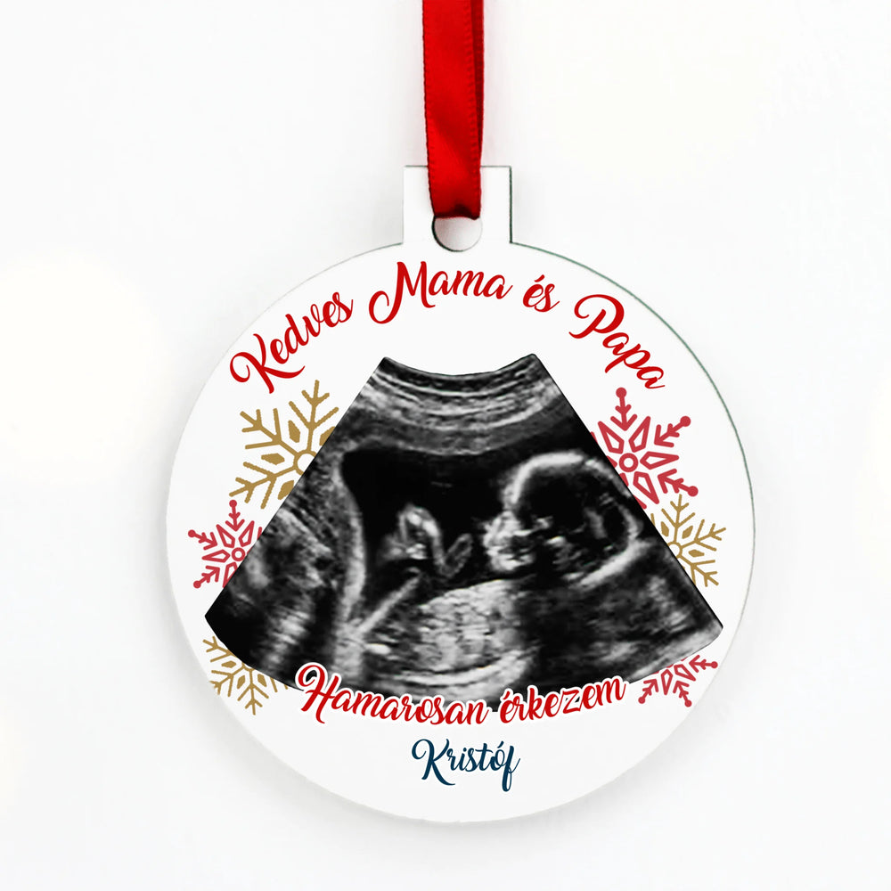 Egyedi feliratos kör karácsonyfadísz ultrahang fotóval