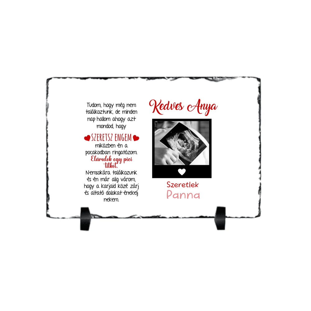 Egyedi ultrahang képes gránitlap Várandós Anyukáknak