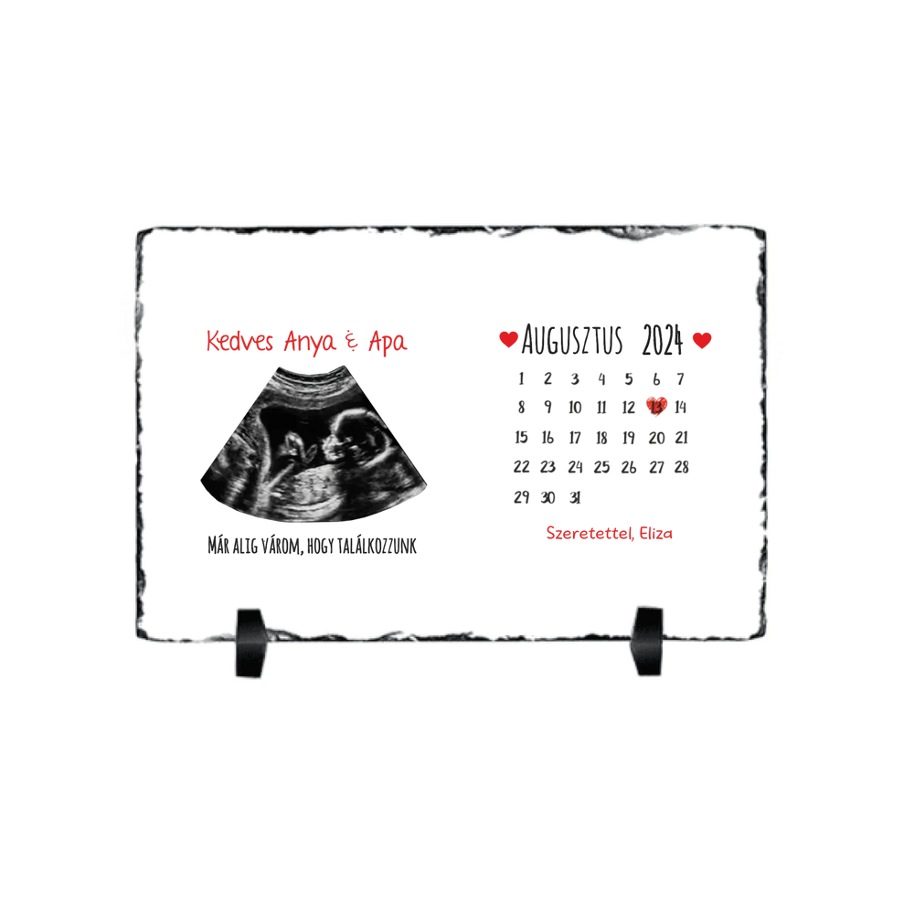 Egyedi ultrahang képes gránitlap naptárral, Várandós Anyukáknak