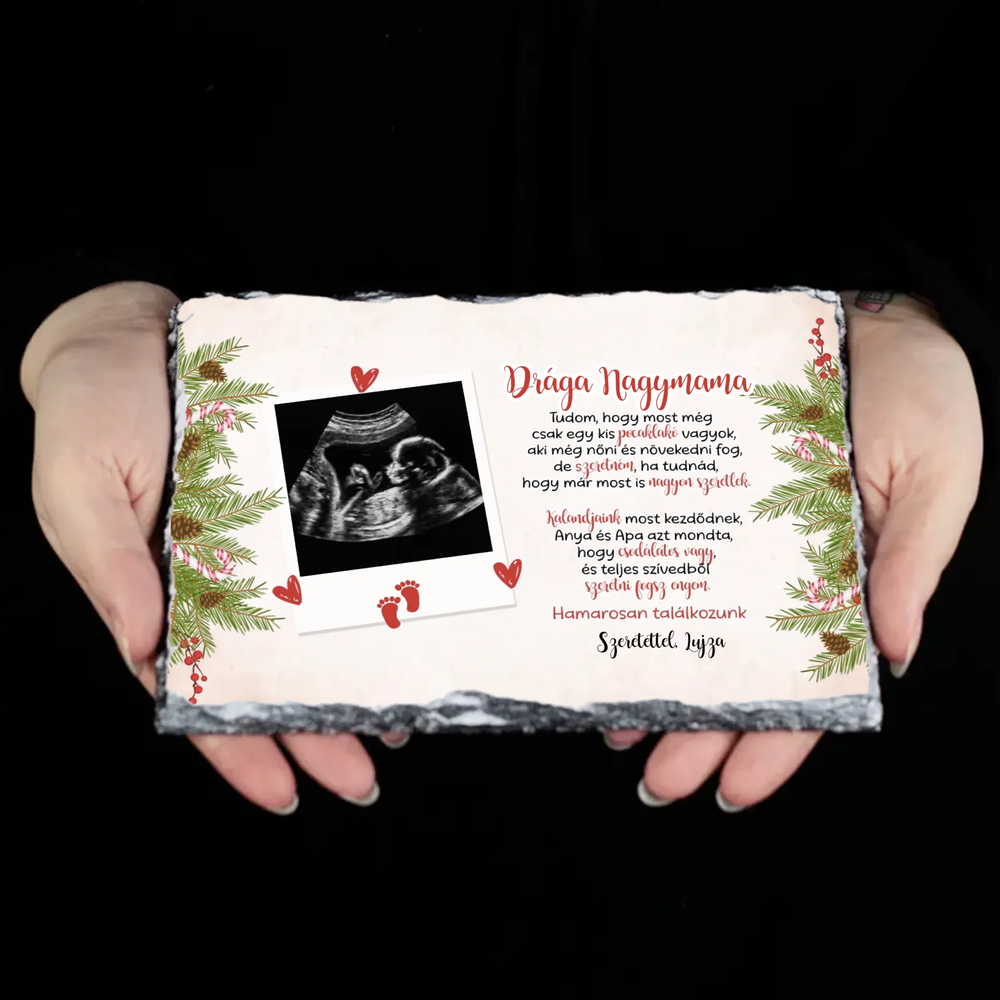 Ultrahang fotós ajándék gránitlap szerkeszthető felirattal