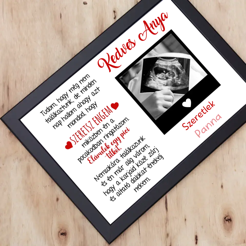 Egyedi ultrahang képes falikép Várandós Anyukáknak