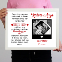 Egyedi ultrahang képes falikép Várandós Anyukáknak