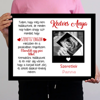 Egyedi ultrahang képes falikép Várandós Anyukáknak