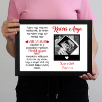 Egyedi ultrahang képes falikép Várandós Anyukáknak