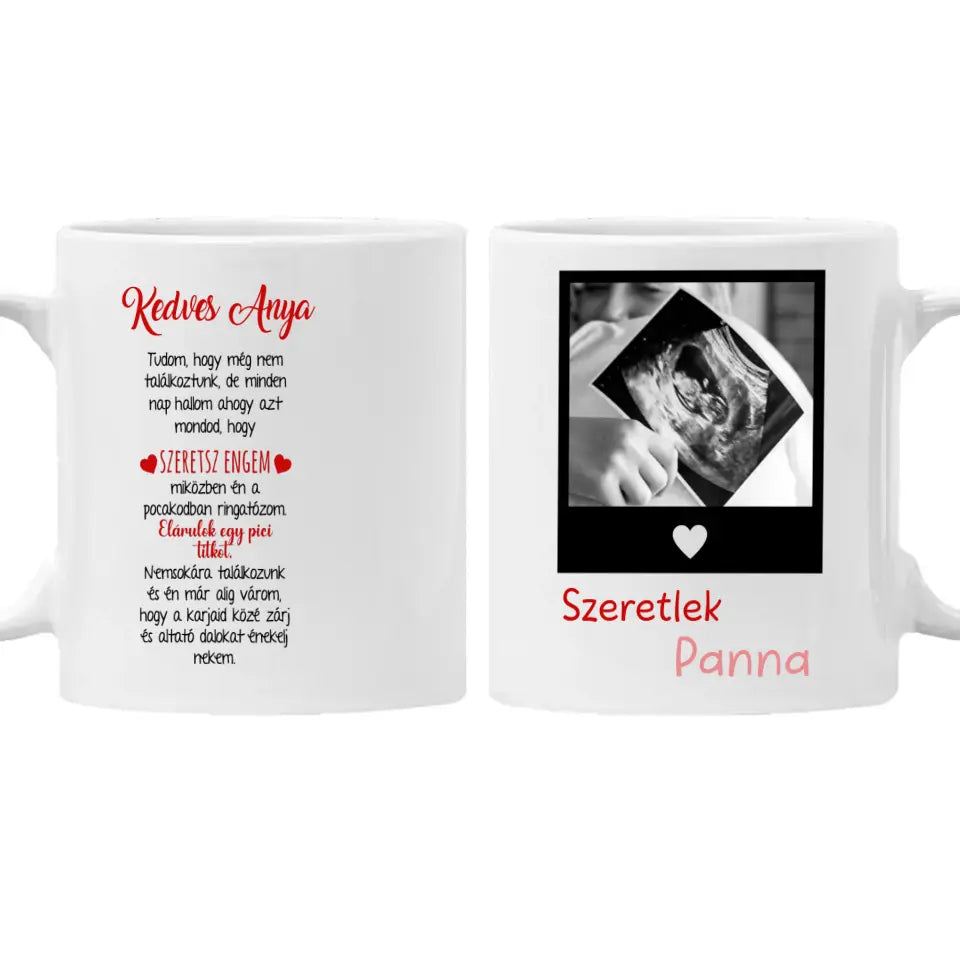 Egyedi ultrahang képes bögre Várandós Anyukáknak