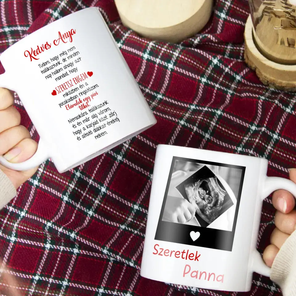 Egyedi ultrahang képes bögre Várandós Anyukáknak