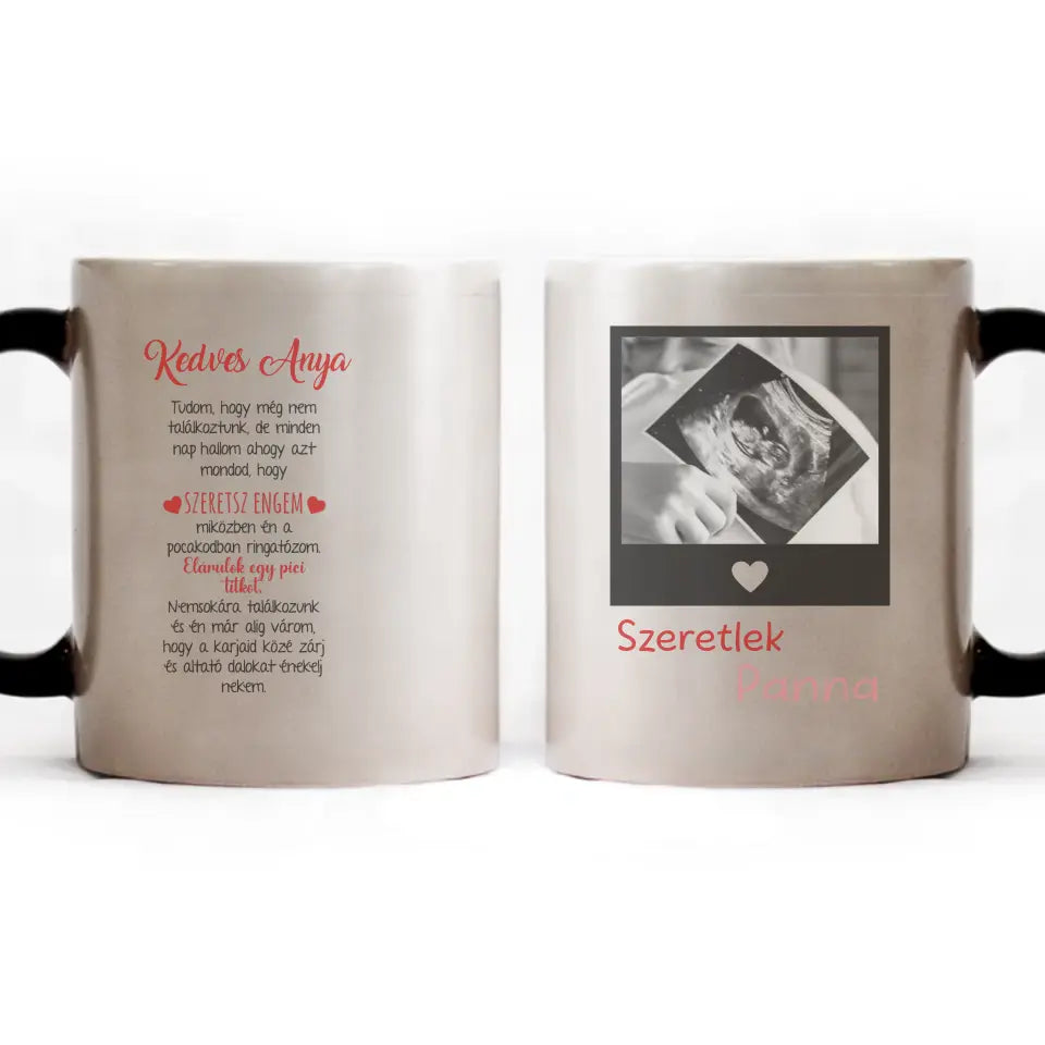 Egyedi ultrahang képes bögre Várandós Anyukáknak