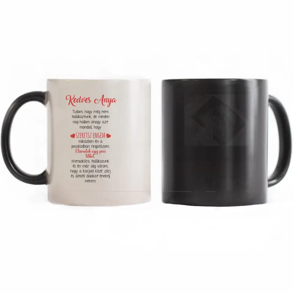 Egyedi ultrahang képes bögre Várandós Anyukáknak