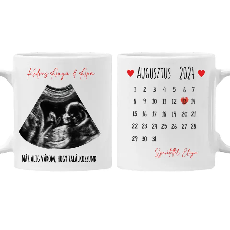 Egyedi ultrahang képes bögre naptárral, Várandós Anyukáknak