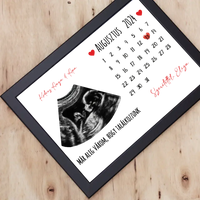 Egyedi ultrahang képes falikép naptárral, Várandós Anyukáknak 