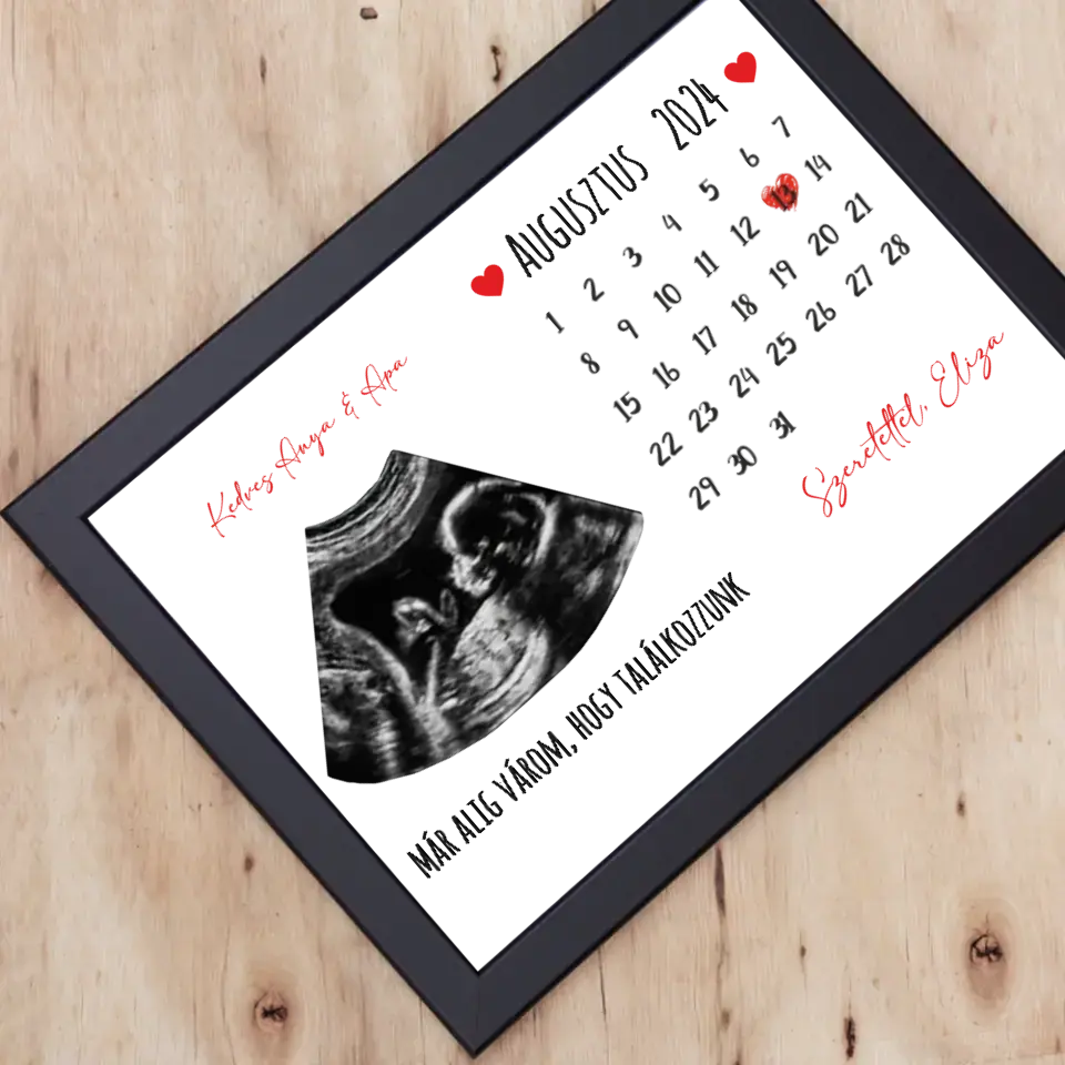 Egyedi ultrahang képes falikép naptárral, Várandós Anyukáknak 