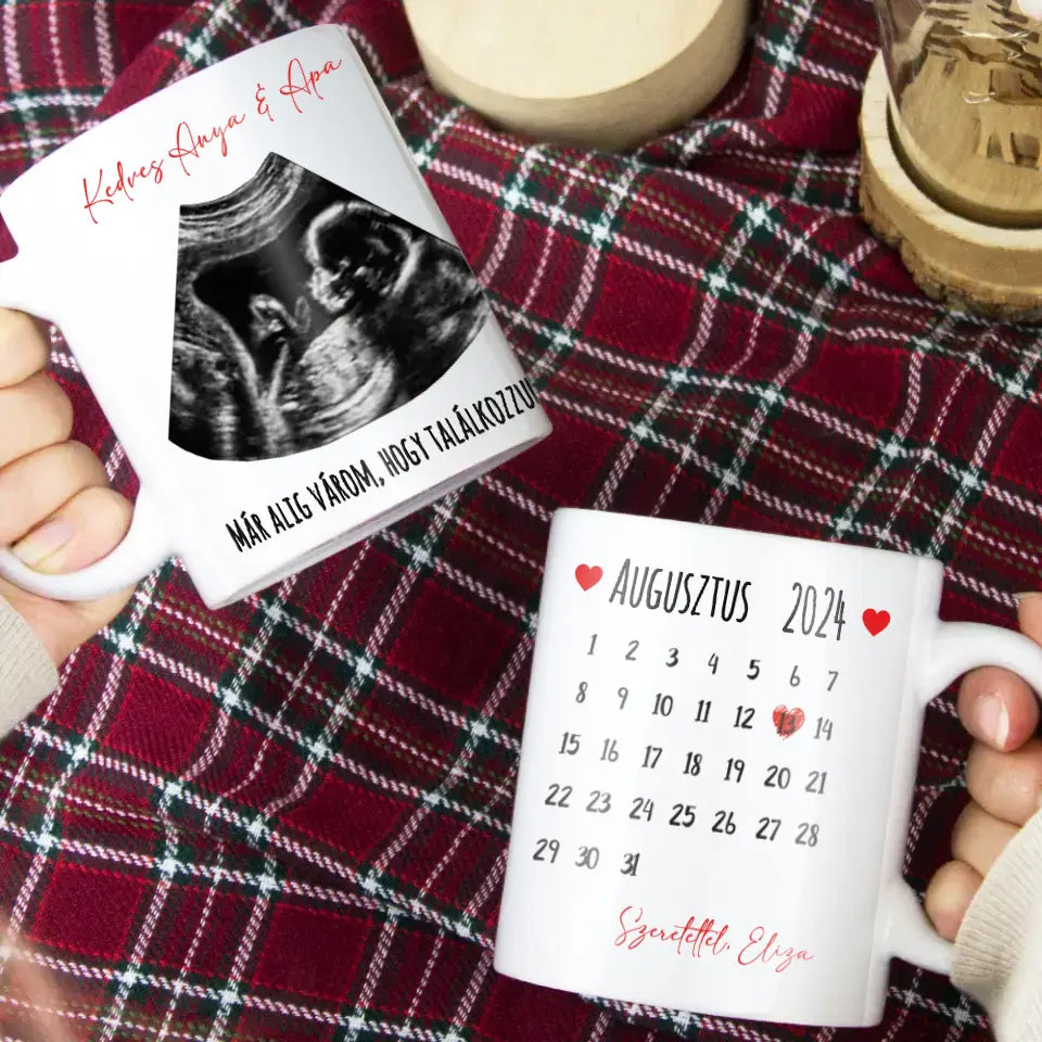 Egyedi ultrahang képes bögre naptárral, Várandós Anyukáknak