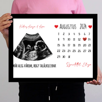 Egyedi ultrahang képes falikép naptárral, Várandós Anyukáknak 