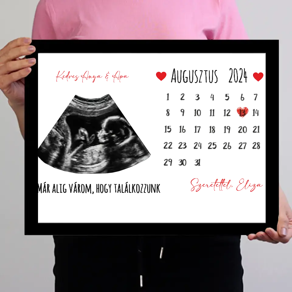 Egyedi ultrahang képes falikép naptárral, Várandós Anyukáknak 