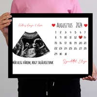 Egyedi ultrahang képes falikép naptárral, Várandós Anyukáknak
