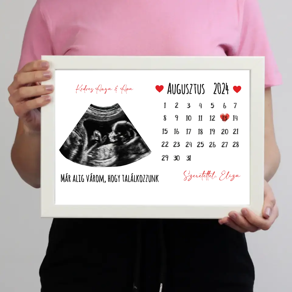 Egyedi ultrahang képes falikép naptárral, Várandós Anyukáknak 