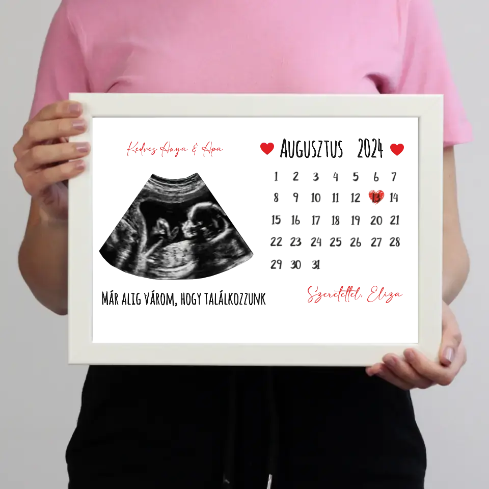 Egyedi ultrahang képes falikép naptárral, Várandós Anyukáknak