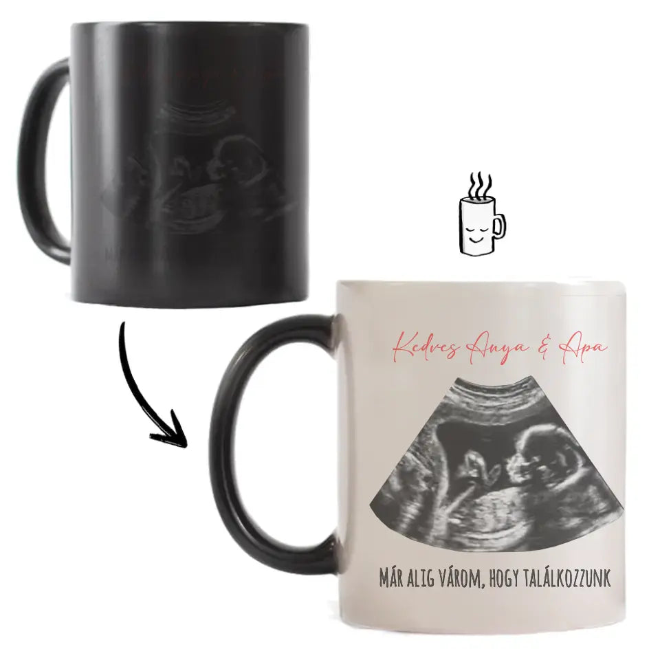 Egyedi ultrahang képes bögre naptárral, Várandós Anyukáknak