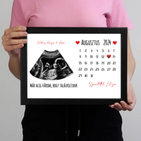 Egyedi ultrahang képes falikép naptárral, Várandós Anyukáknak 