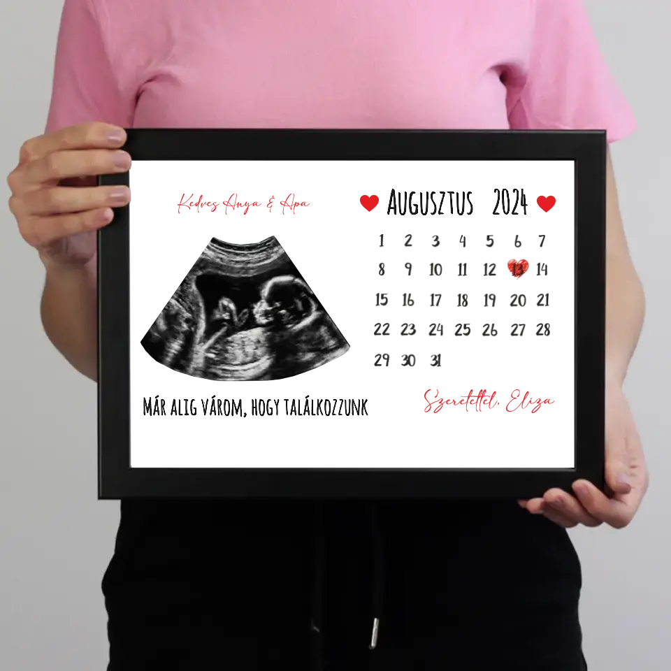 Egyedi ultrahang képes falikép naptárral, Várandós Anyukáknak 