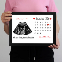 Egyedi ultrahang képes falikép naptárral, Várandós Anyukáknak