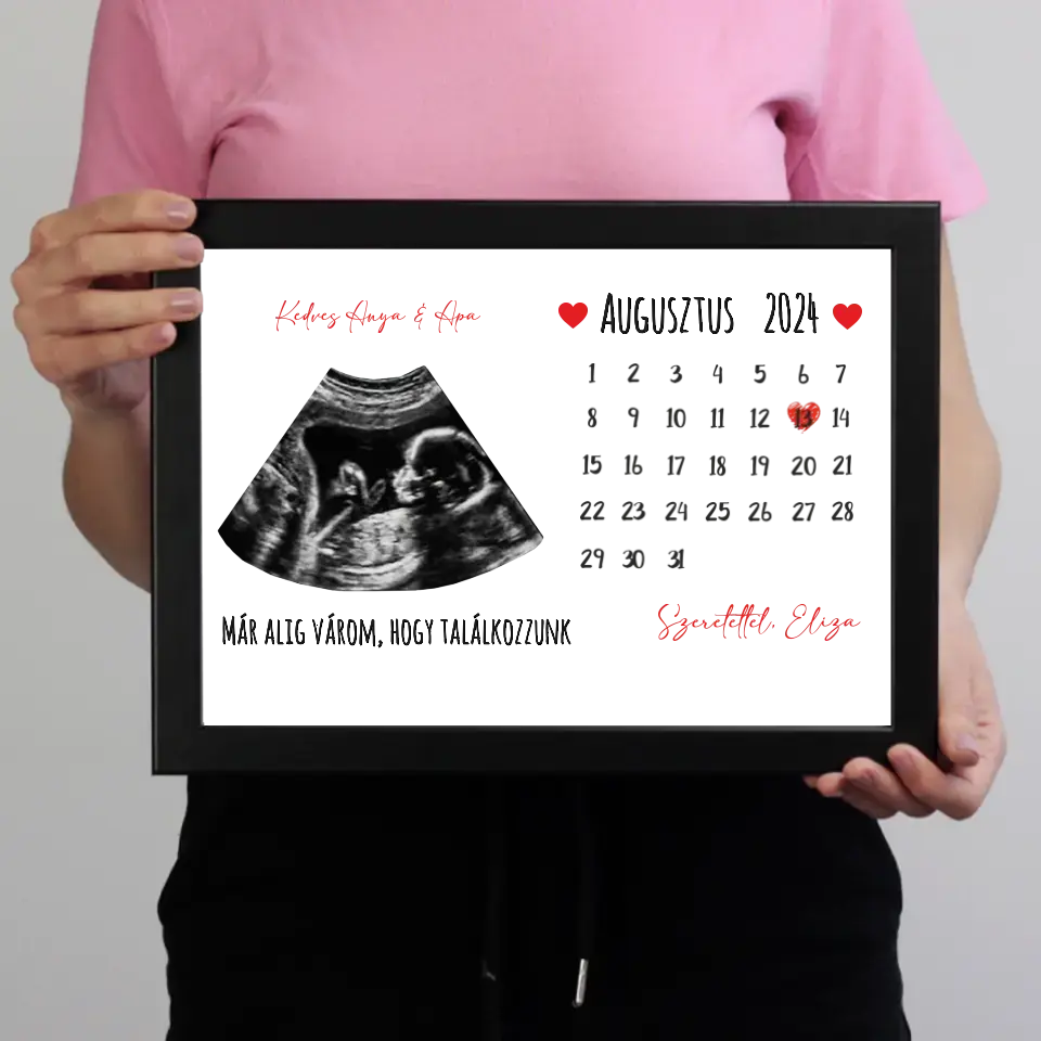 Egyedi ultrahang képes falikép naptárral, Várandós Anyukáknak