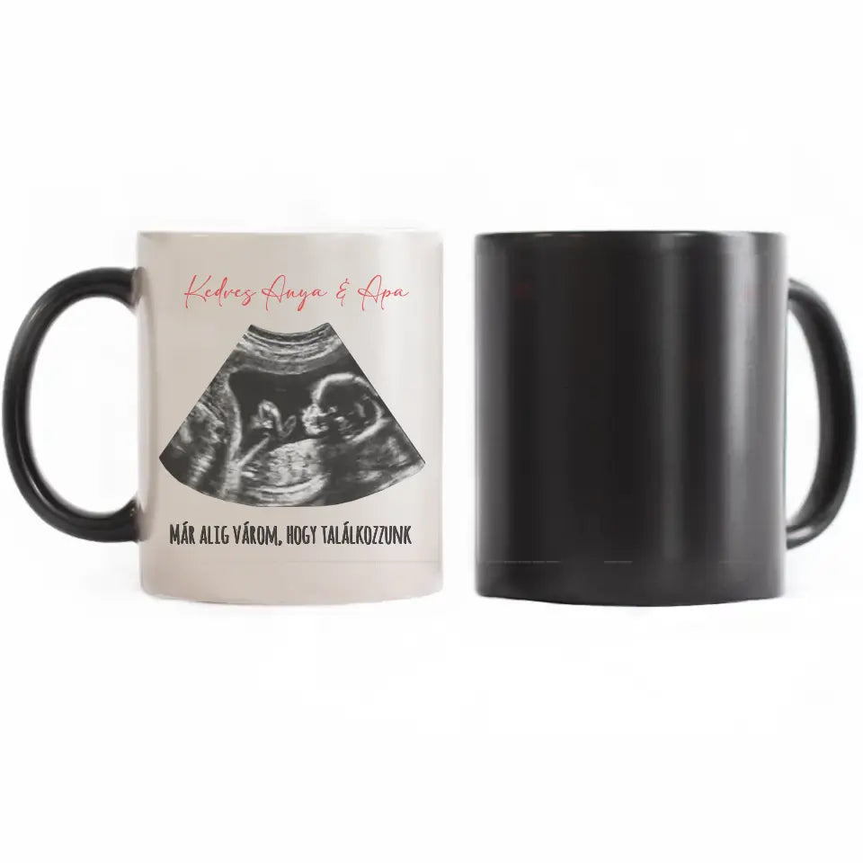 Egyedi ultrahang képes bögre naptárral, Várandós Anyukáknak