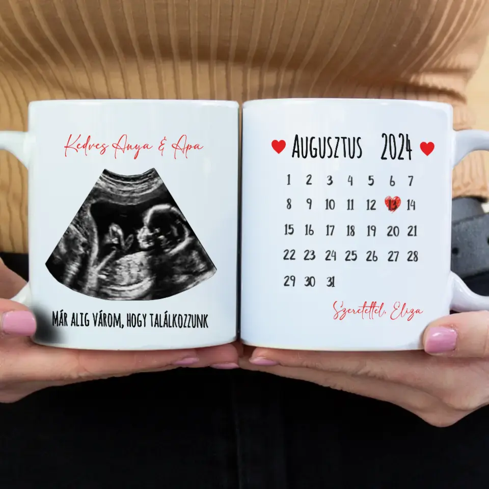Egyedi ultrahang képes bögre naptárral, Várandós Anyukáknak
