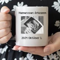 Hamarosan érkezem, ultrahang képes bögre leendő Apukáknak