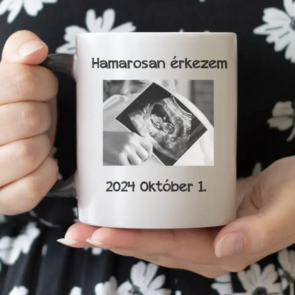 Hamarosan érkezem, ultrahang képes bögre leendő Apukáknak