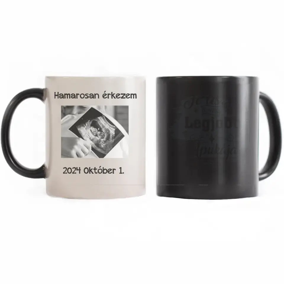 Hamarosan érkezem, ultrahang képes bögre leendő Apukáknak