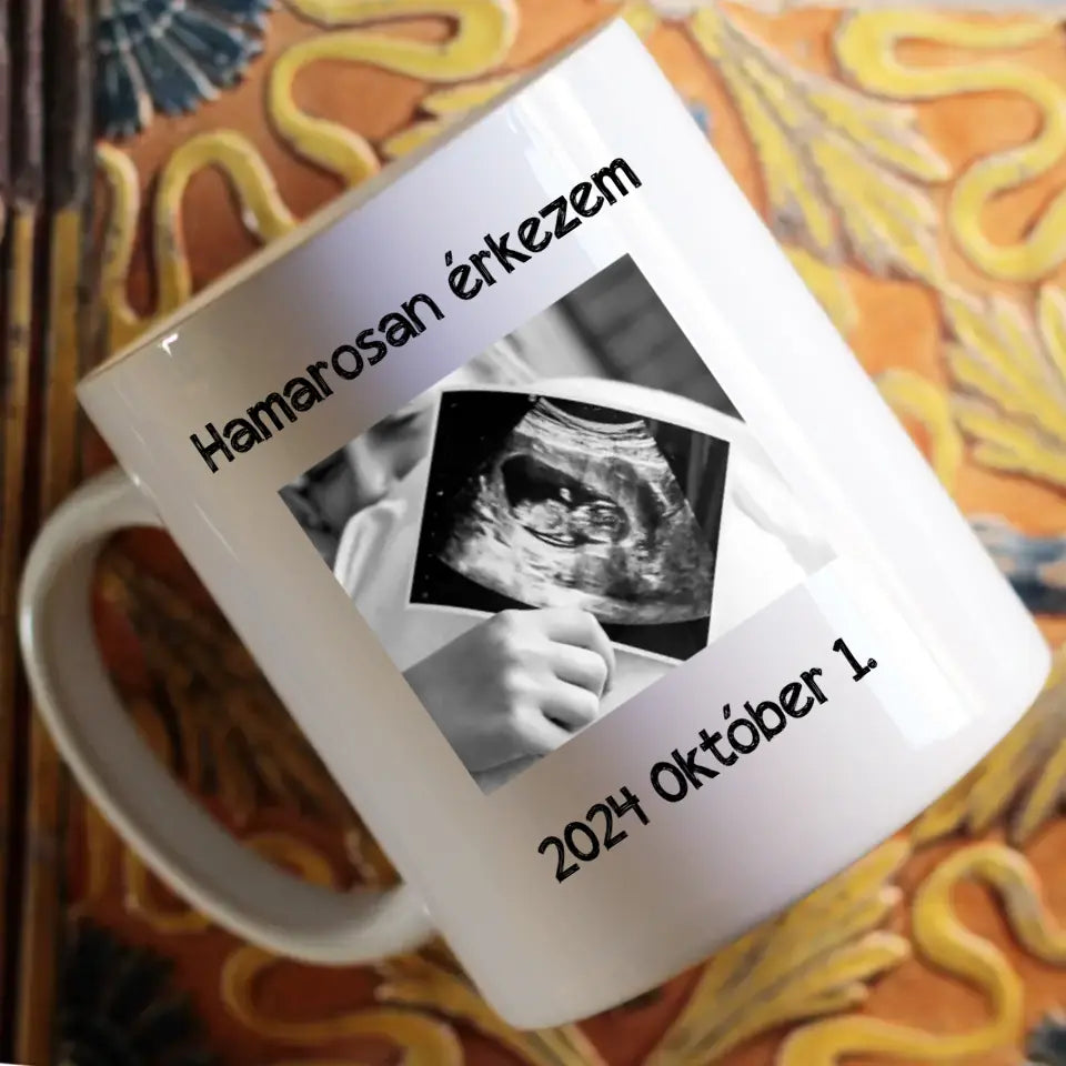 Hamarosan érkezem, ultrahang képes bögre leendő Apukáknak