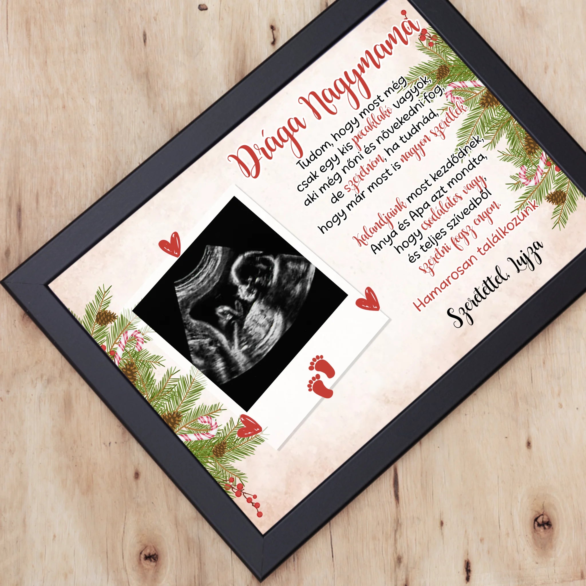 Ultrahang fotós ajándék falikép szerkeszthető felirattal