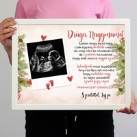 Ultrahang fotós ajándék falikép szerkeszthető felirattal