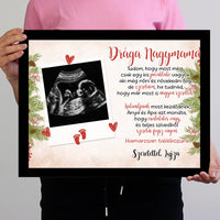 Ultrahang fotós ajándék falikép szerkeszthető felirattal