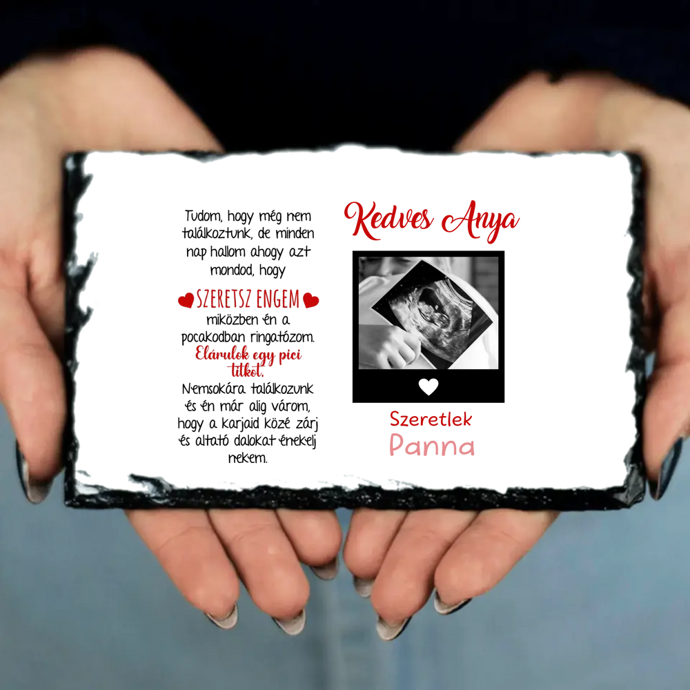 Egyedi ultrahang képes gránitlap Várandós Anyukáknak