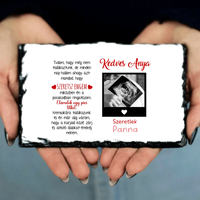 Egyedi ultrahang képes gránitlap Várandós Anyukáknak