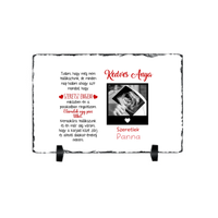 Egyedi ultrahang képes gránitlap Várandós Anyukáknak