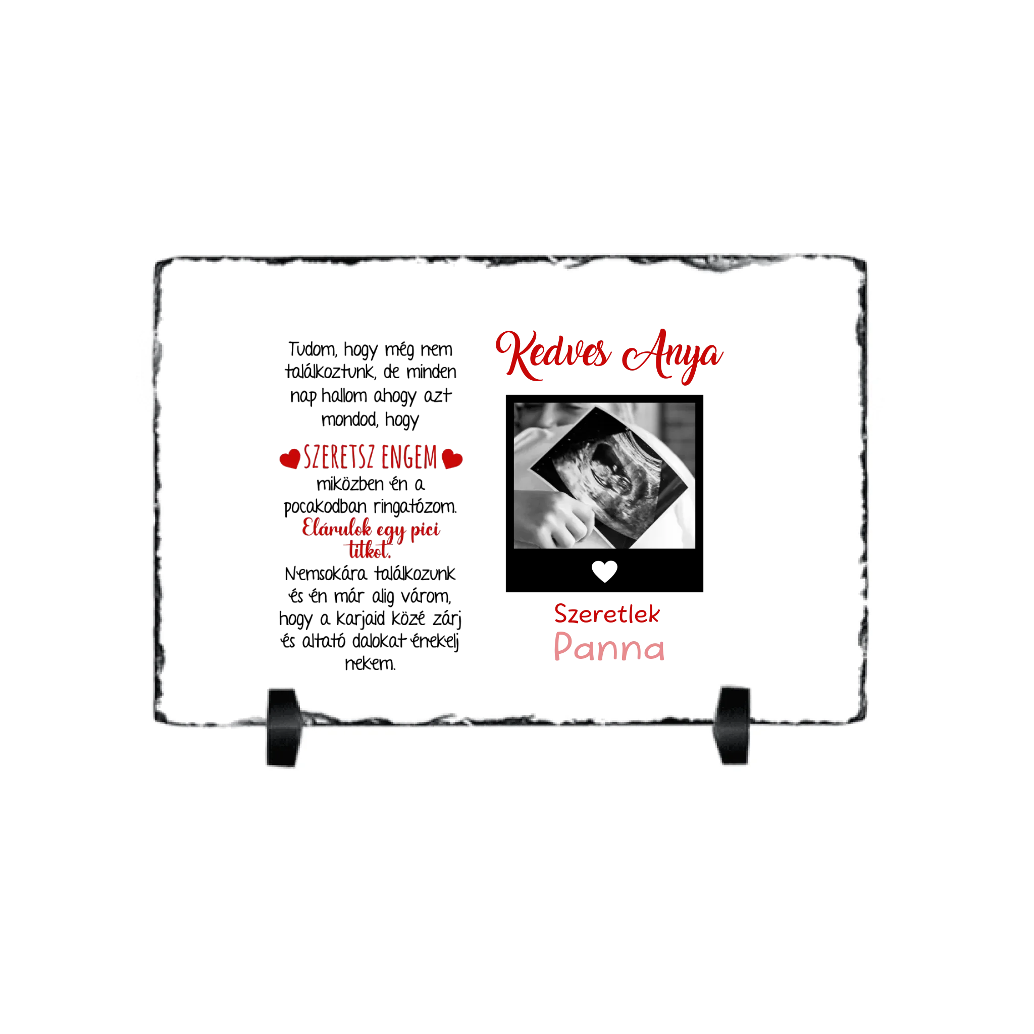 Egyedi ultrahang képes gránitlap Várandós Anyukáknak