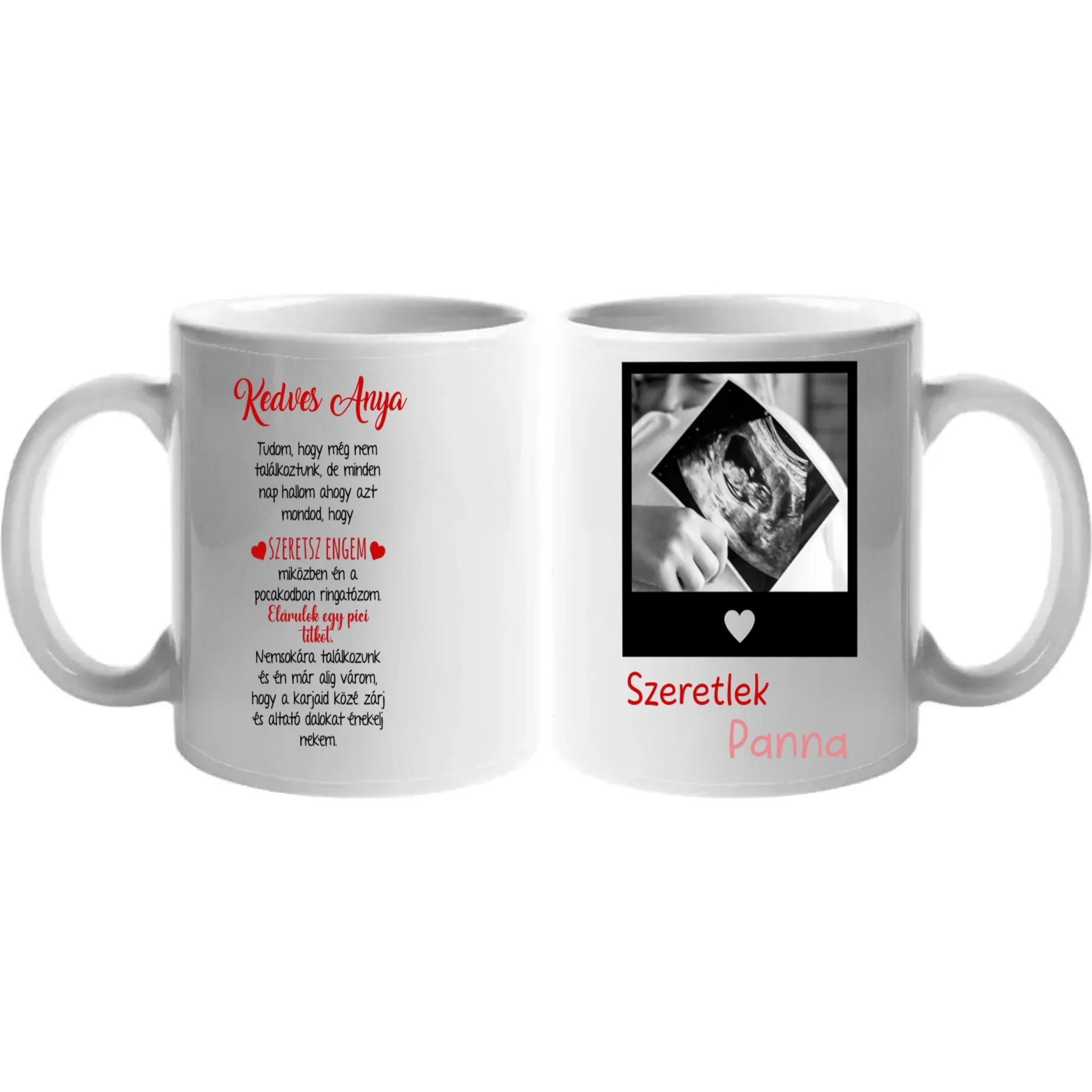 Egyedi ultrahang képes bögre Várandós Anyukáknak