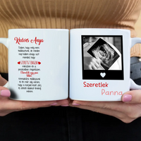 Egyedi ultrahang képes bögre Várandós Anyukáknak