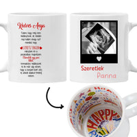 Egyedi ultrahang képes bögre Várandós Anyukáknak