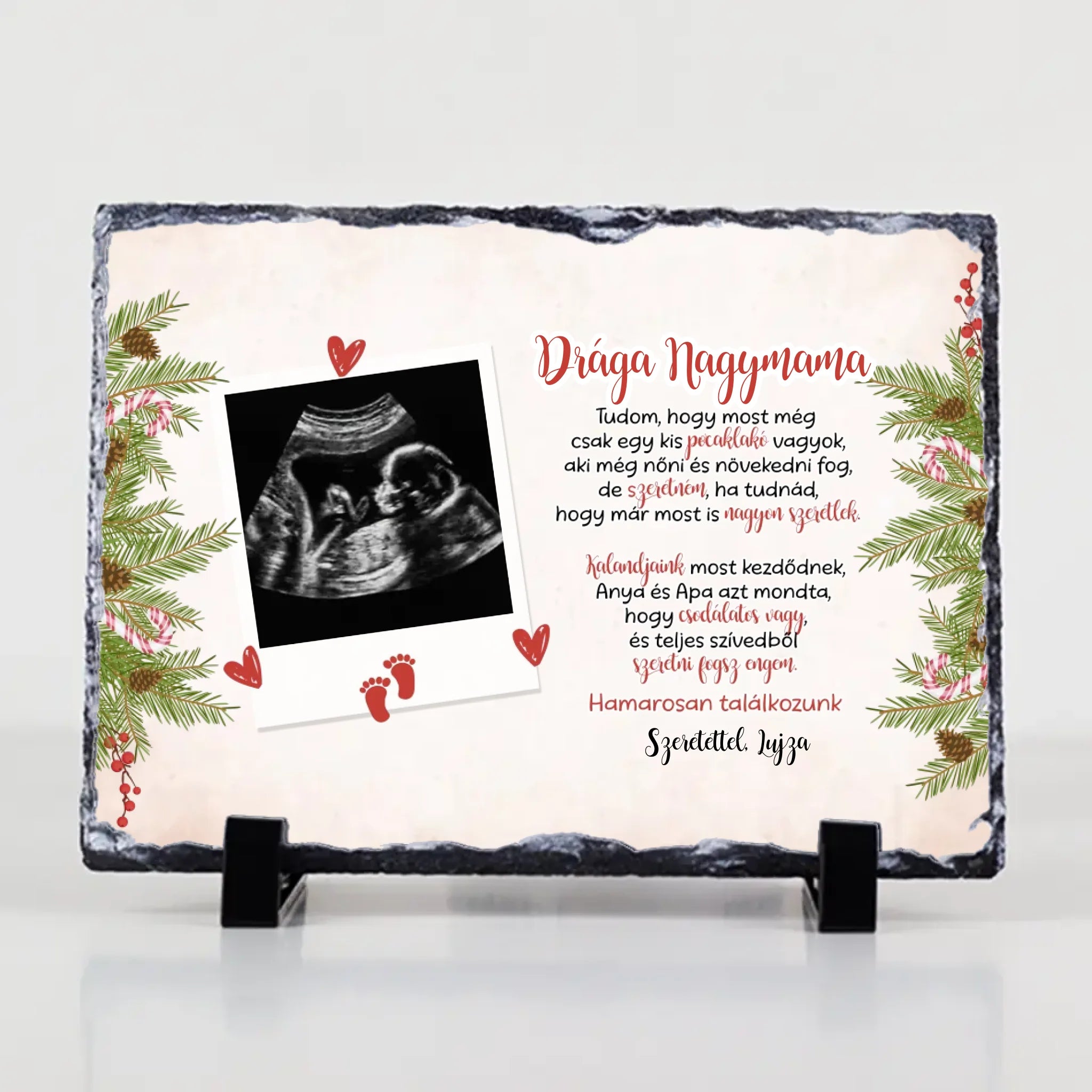 Ultrahang fotós ajándék gránitlap szerkeszthető felirattal
