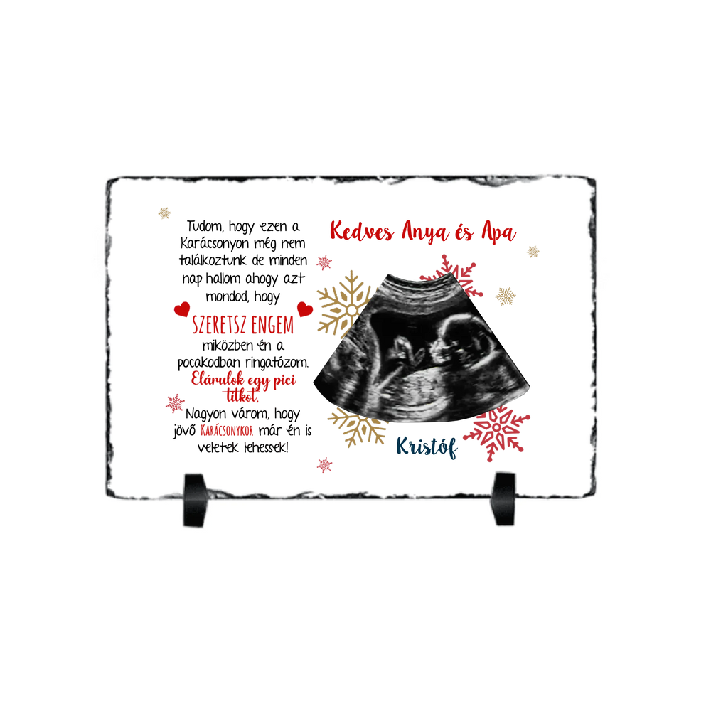 Ajándék karácsonyi gránitlap ultrahang fotóval és szerkeszthető felirattal