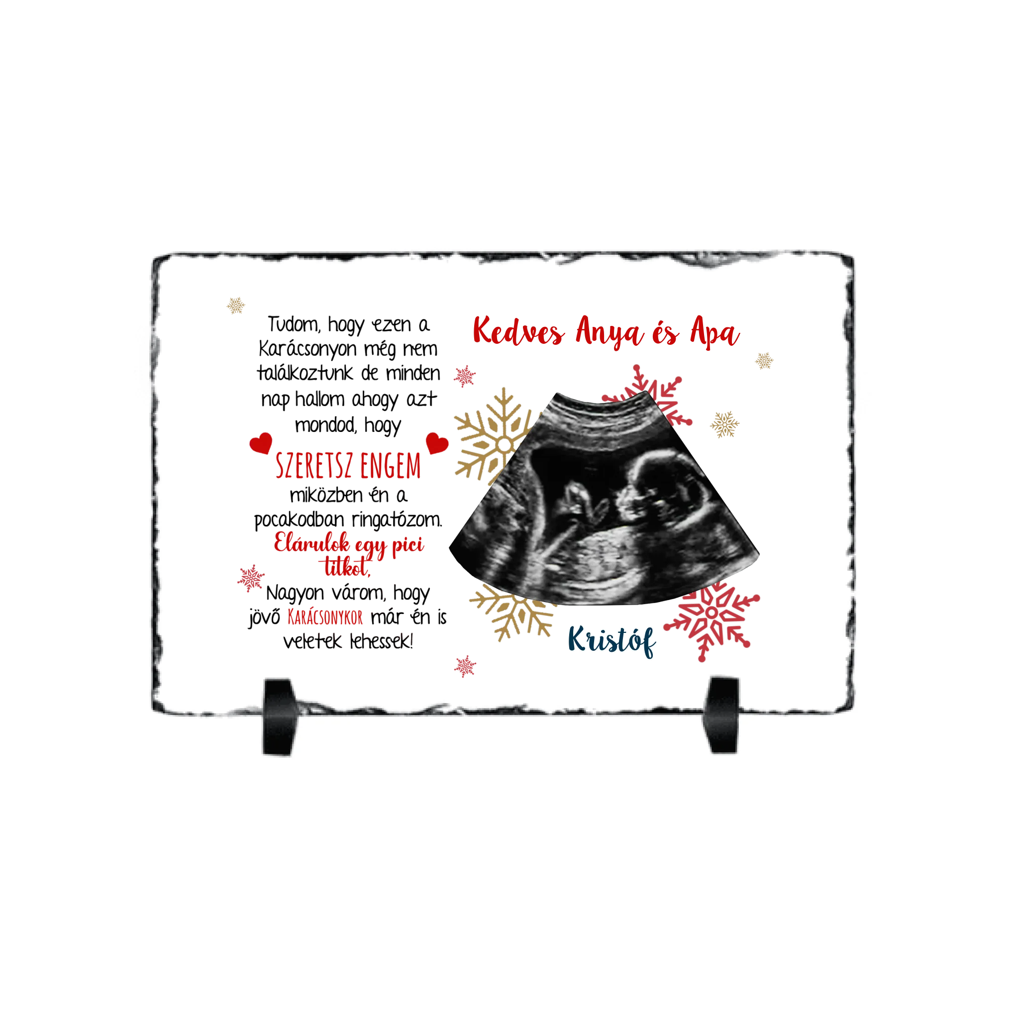 Ajándék karácsonyi gránitlap ultrahang fotóval és szerkeszthető felirattal