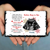 Ajándék karácsonyi gránitlap ultrahang fotóval és szerkeszthető felirattal